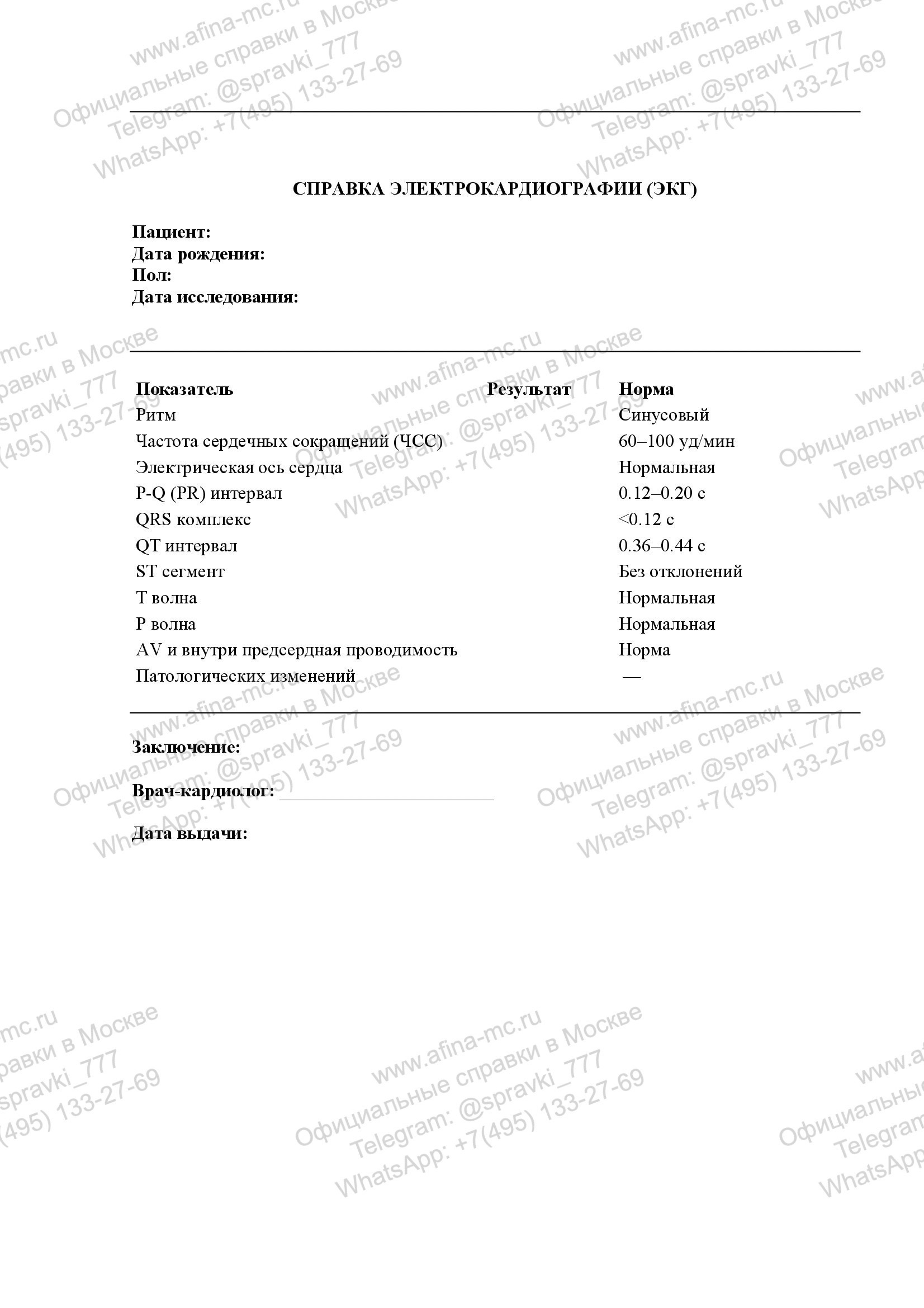 Справка о проведении ЭКГ с нагрузкой и без нагрузки